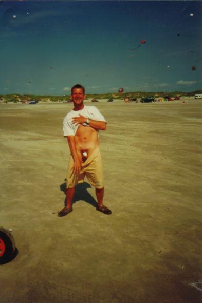 21.4 Buggy naked injury, Fano 1998